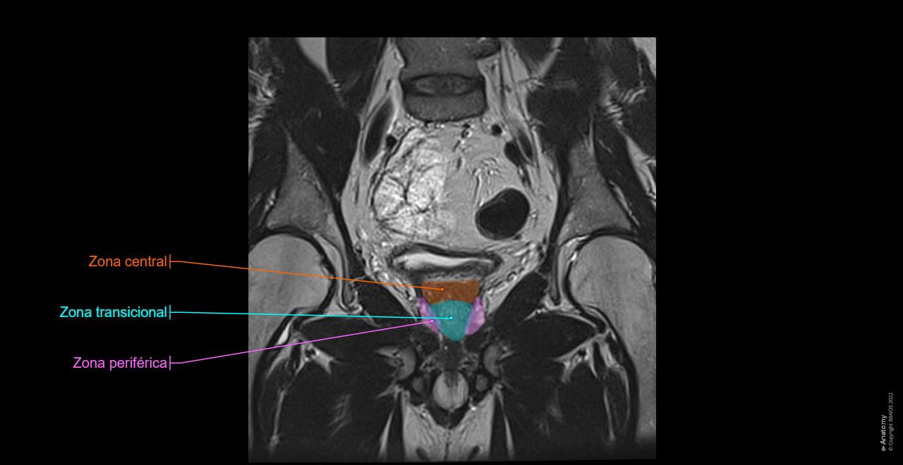 Pelvis Masculina Anatom a Normal E Anatomy pelvis-masculina-anatom-a-normal-e-anatomy