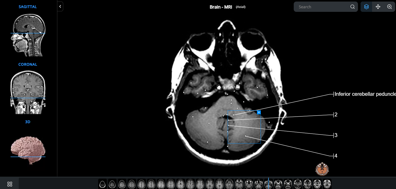 Tutorial for using e-Anatomy - IMAIOS