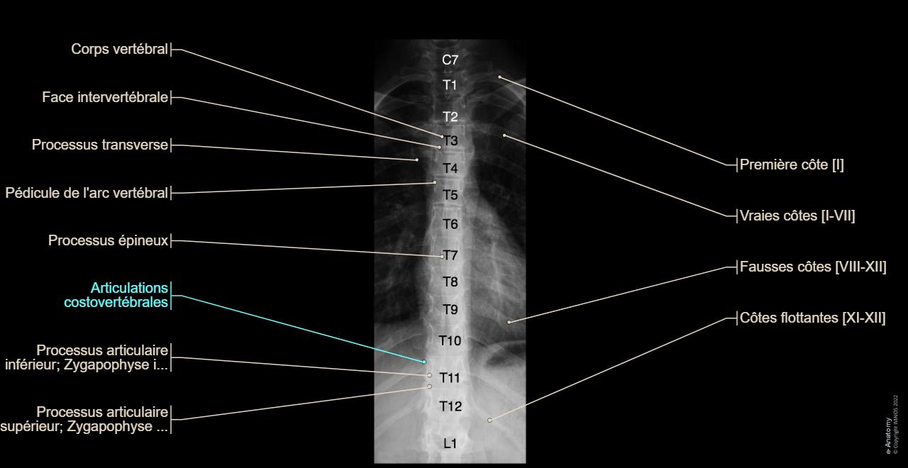 Eos Rachis Rachis Radios standards : anatomie normale | e-Anatomy