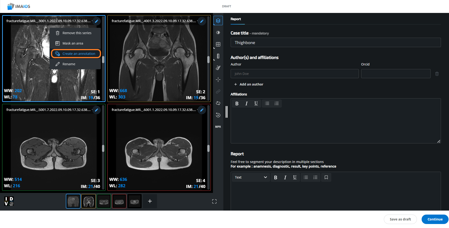 Ecase Overview e-Cases, a collaborative database of radiology clinical cases