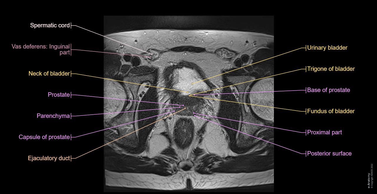 Prostate Mri Anatomy