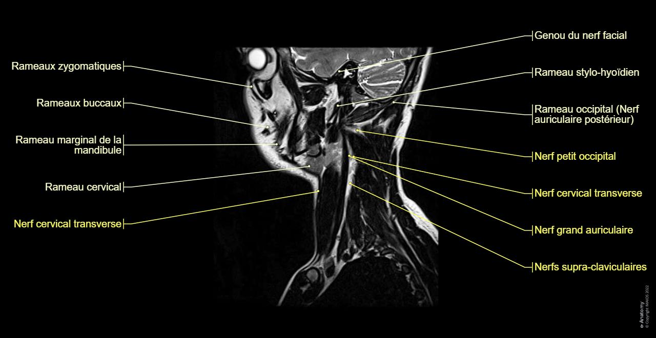 Cavit Irm Rct Face et cou IRM : anatomie normale | e-Anatomy