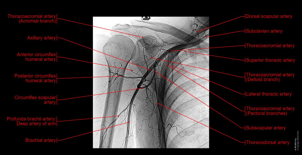 Shoulder MRI: normal anatomy | e-Anatomy