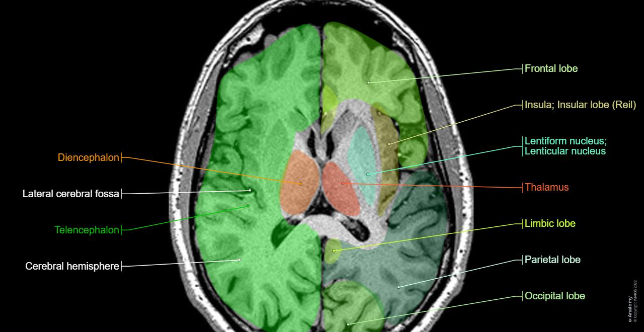 Normal Brain Mri Labeled Magnetic Resonance Images Of The Brain (MRI