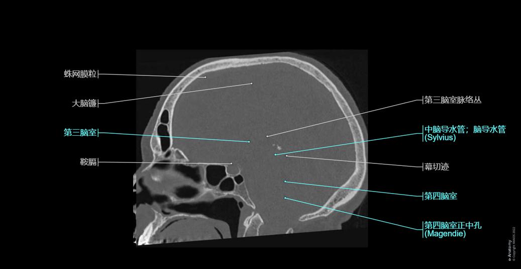 头部 CT : 正常解剖 | e-Anatomy