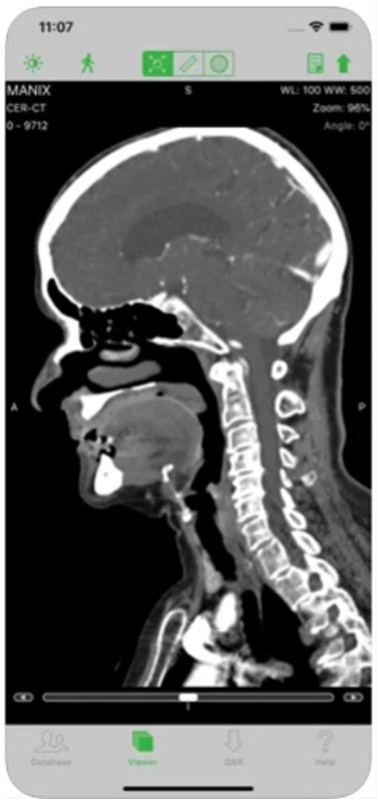Dicom Ios Best mobile DICOM viewer (Android and iOS)