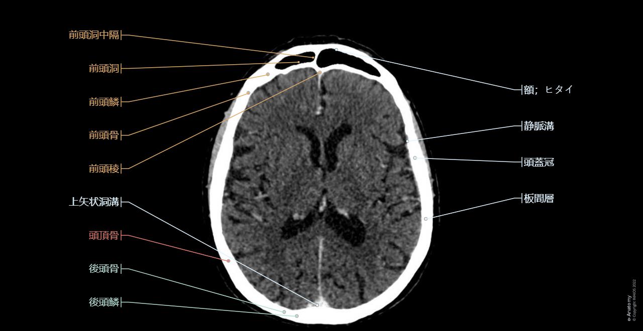 頭頚部 CT: 正常解剖学 | e-Anatomy