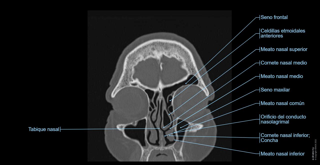 Anatomía Del Cuello Por Tc 06. Vísceras Del Cuello | Enfermería