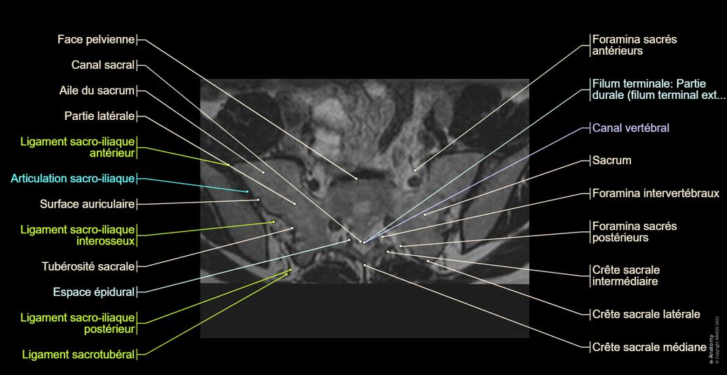 Anteversion Sacrum Rachis lombaire : anatomie normale | e-Anatomy
