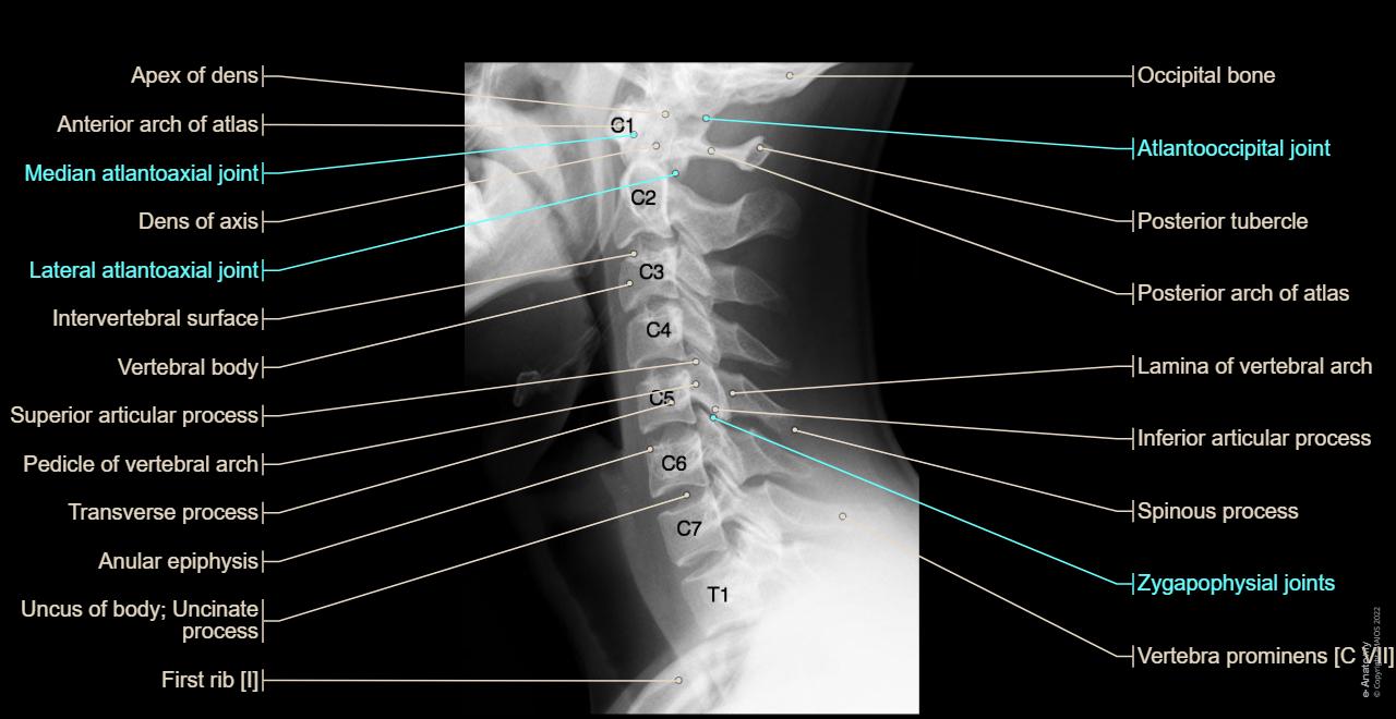 Cervical spine lateral X-ray with anatomy labels