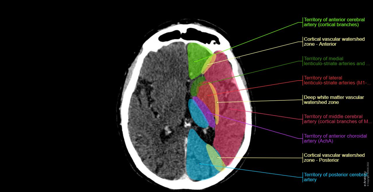 Tc Normal Map Anatomia del cervello e della faccia: TC con didascalie - e-Anatomy