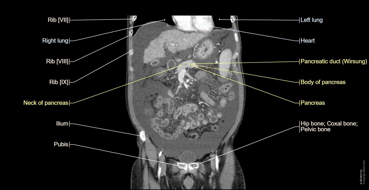 Abdominopelvic Ct CT Abdomen General