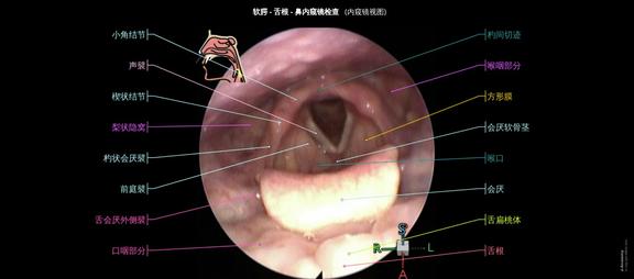 鼻腔、咽部和喉部的解剖结构:内窥镜视图 |e-Anatomy