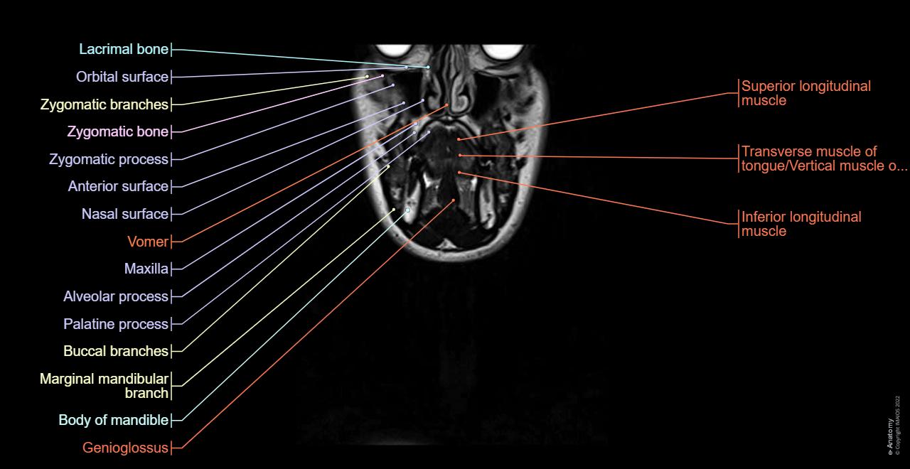 Anatomy of the face and neck (MRI) : normal anatomy | e-Anatomy