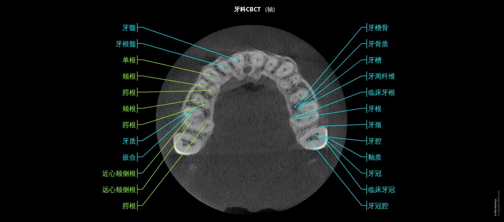 牙齿解剖:附标记的牙齿锥形束计算机断层成像 | e-Anatomy