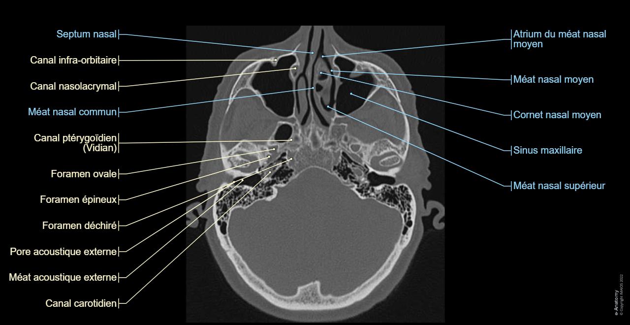 Anatomie du crâne : scanner légendé - e-Anatomy