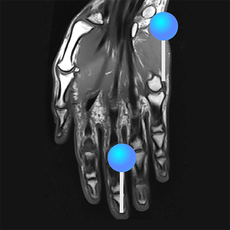 Mri Righ Hand e-Anatomy, the Anatomy of Imaging