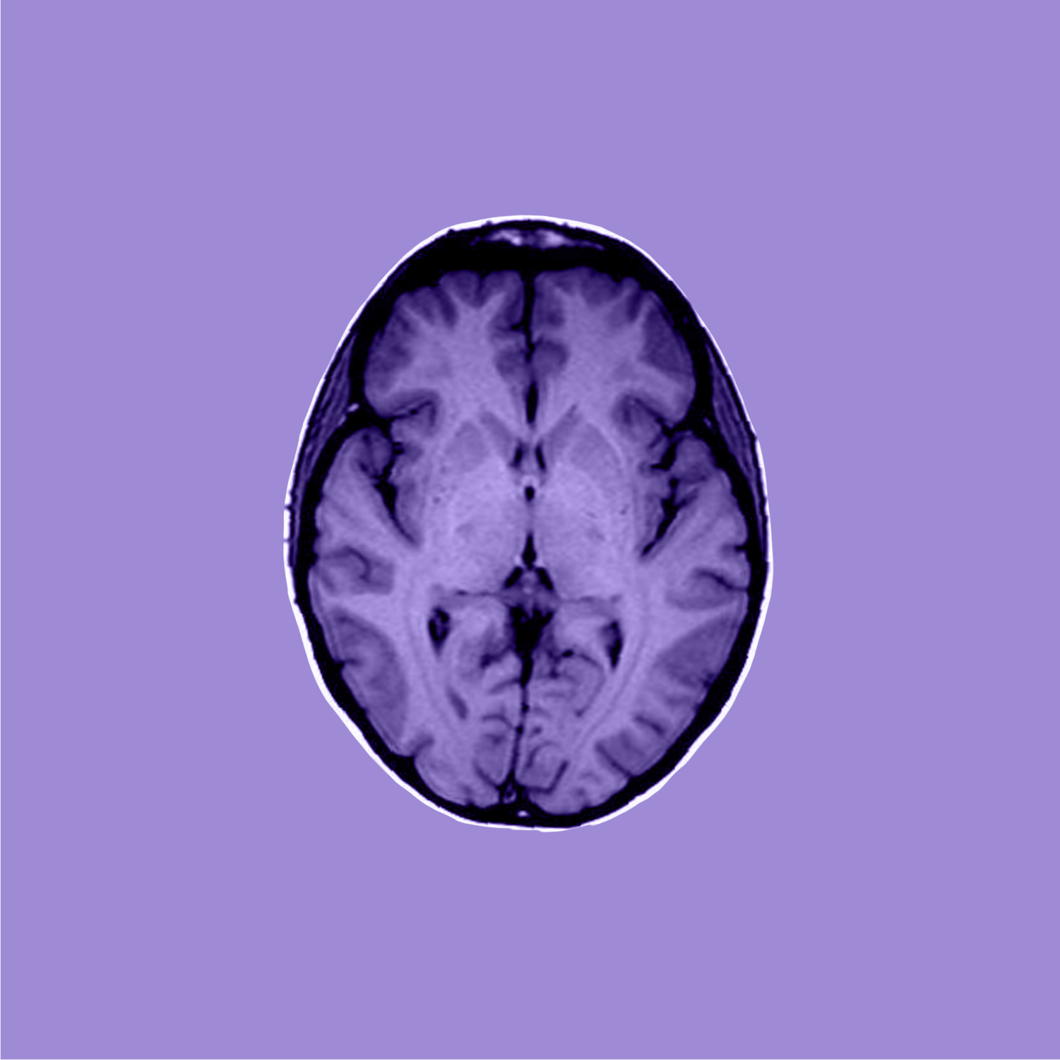 MRI image formation: spatial frequency, image resolution and contrast ...
