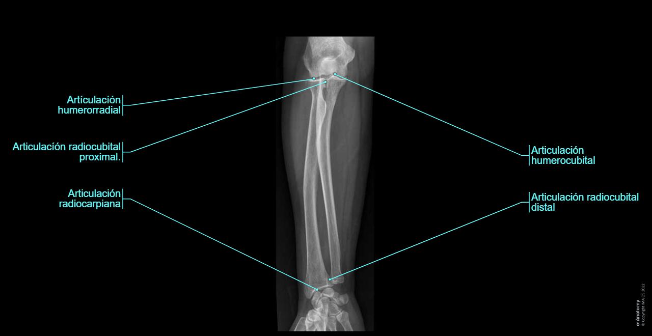 Anatomía radiológica de la extremidad superior: anatomía normal | e-Anatomy