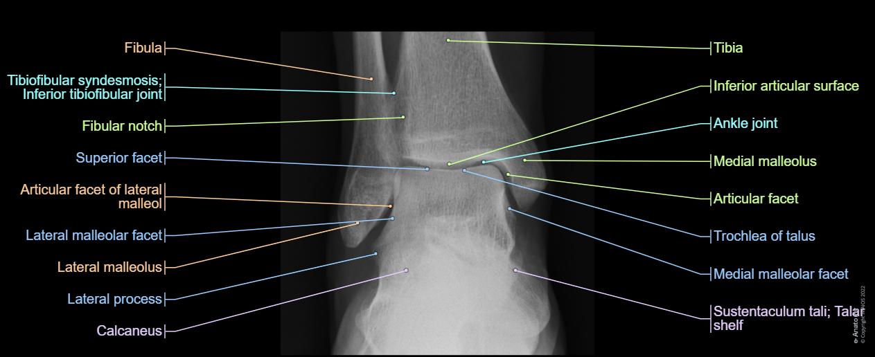 Angulo Tobillo Radiological anatomy of the lower limb | e-Anatomy