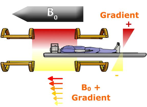 Magnetogram Gradient MRI instrumentation and safety: magnetic field gradients | e-MRI