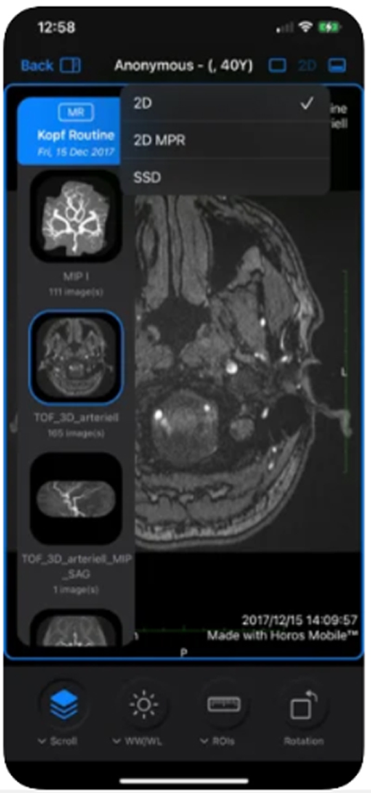 Dicom Ios Best mobile DICOM viewer (Android and iOS)
