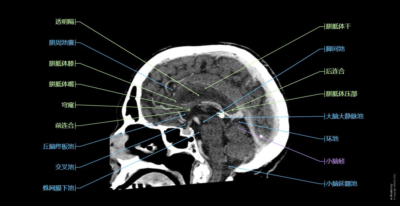 头部 CT : 正常解剖 | e-Anatomy