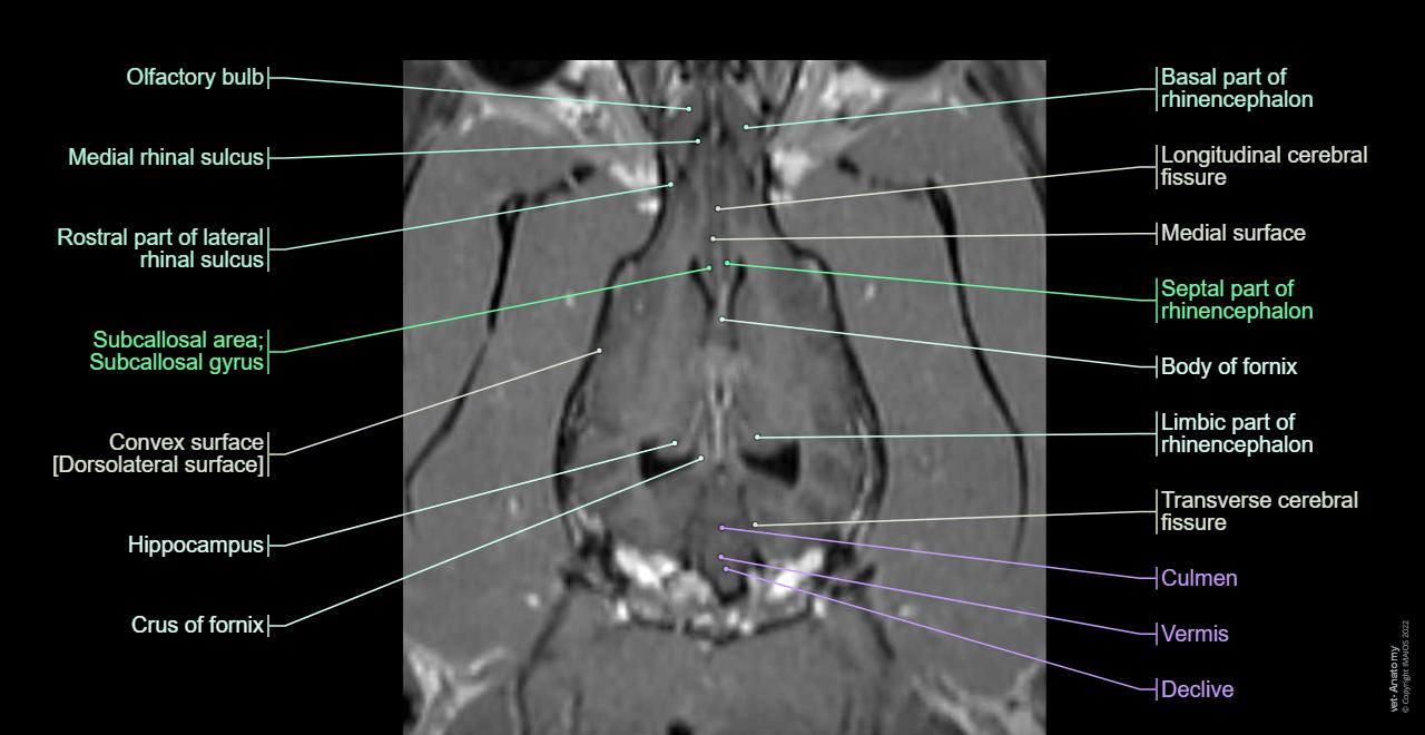 Canine Brain MRI Atlas Veterinary Radiology Normal Anatomy Vet Anatomy canine-brain-mri-atlas-veterinary-radiology-normal-anatomy-vet-anatomy