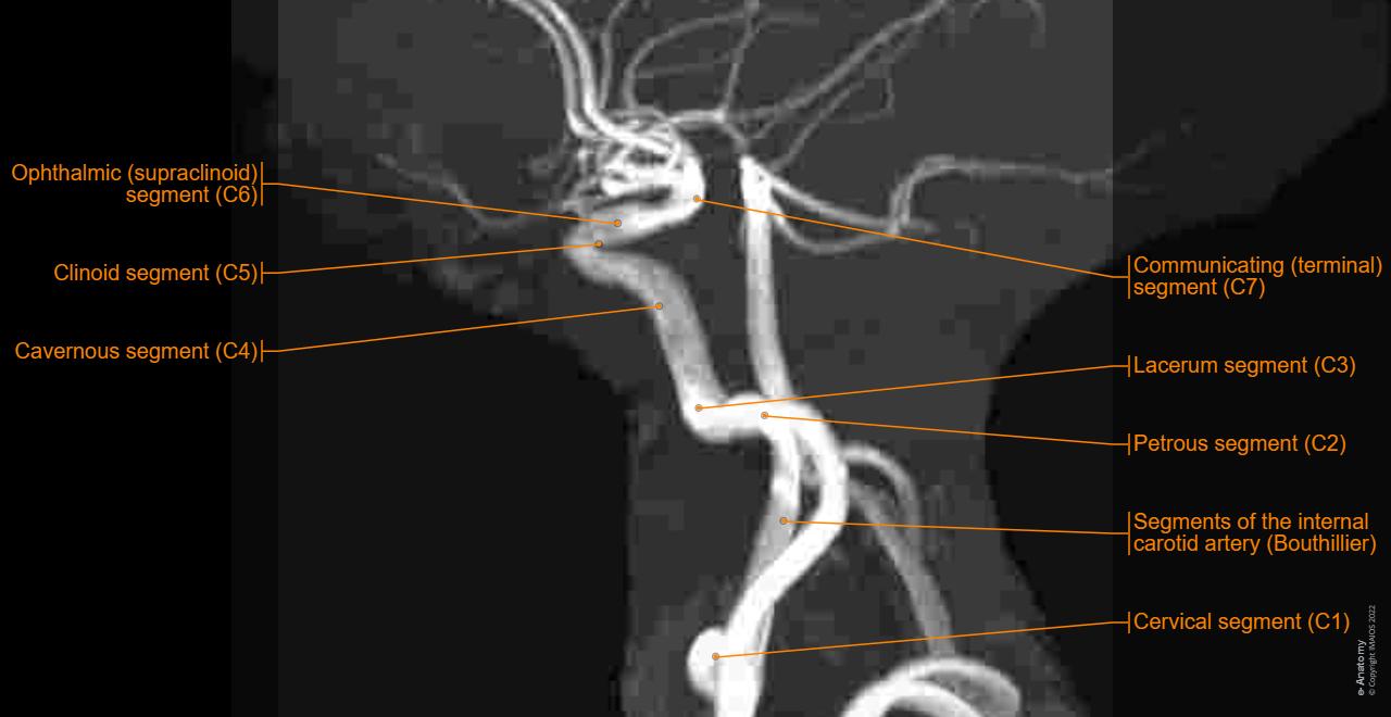 Mra Brain Anatomy 24 Magnetic Resonance Angiography Stock Photos,