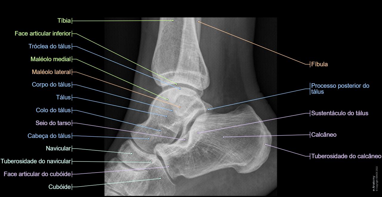 Talus Gc Anatomia radiológica do membro inferior | e-Anatomy