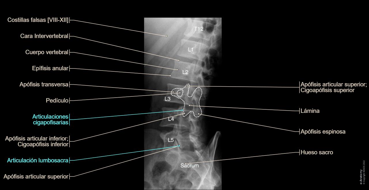 Columna vertebral radiografía estándar : anatomía normal | e-Anatomy