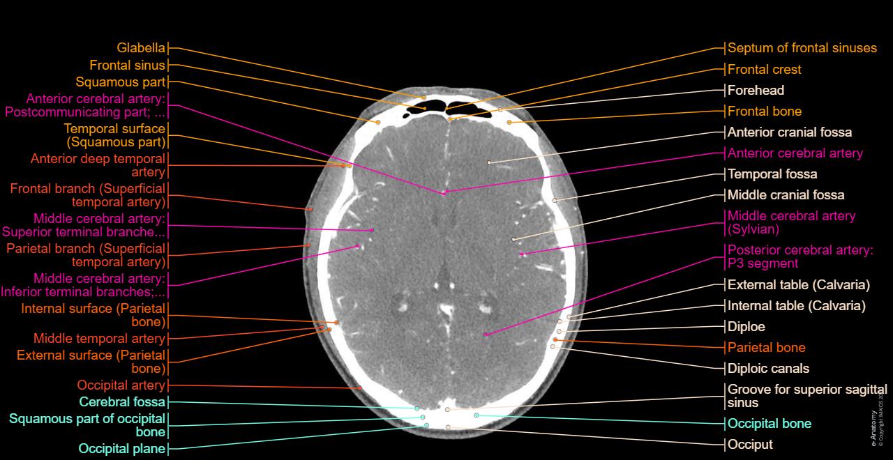 CT scan of head and neck: normal anatomy | e-Anatomy