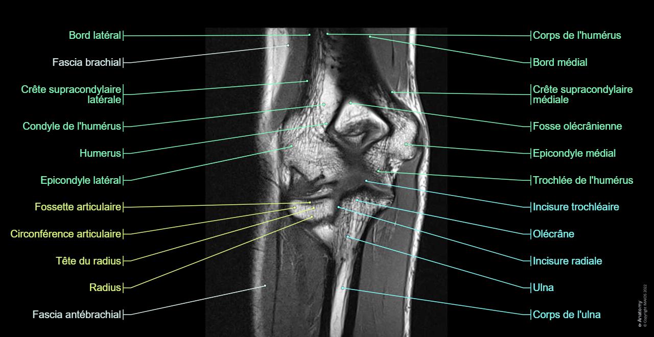 Arthroscanner Du Coude Anatomie Normale E Anatomy arthroscanner-du-coude-anatomie-normale-e-anatomy