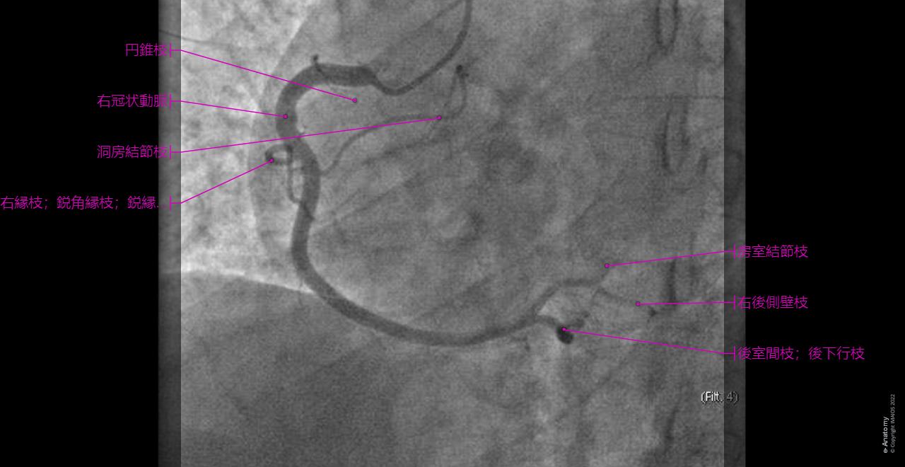 冠動脈 : 正常解剖学 | e-Anatomy