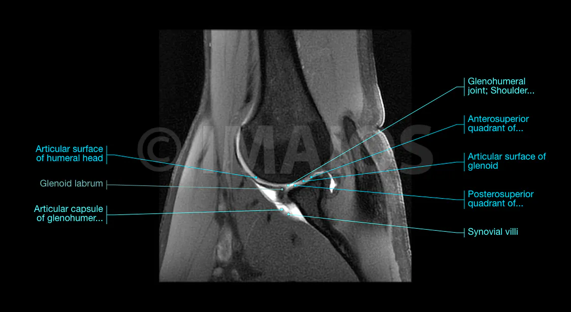 Schulter-Arthro-MRT: normale Anatomie | e-Anatomy