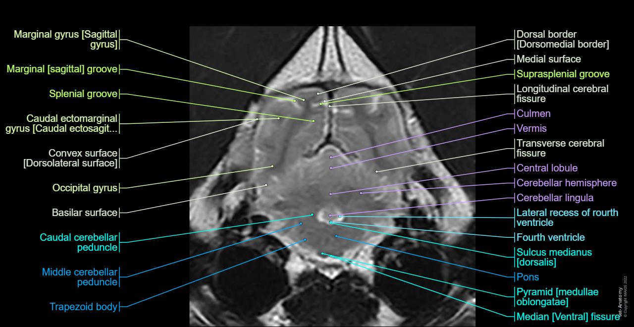 Canine Brain MRI Atlas Veterinary Radiology Normal Anatomy Vet Anatomy canine-brain-mri-atlas-veterinary-radiology-normal-anatomy-vet-anatomy