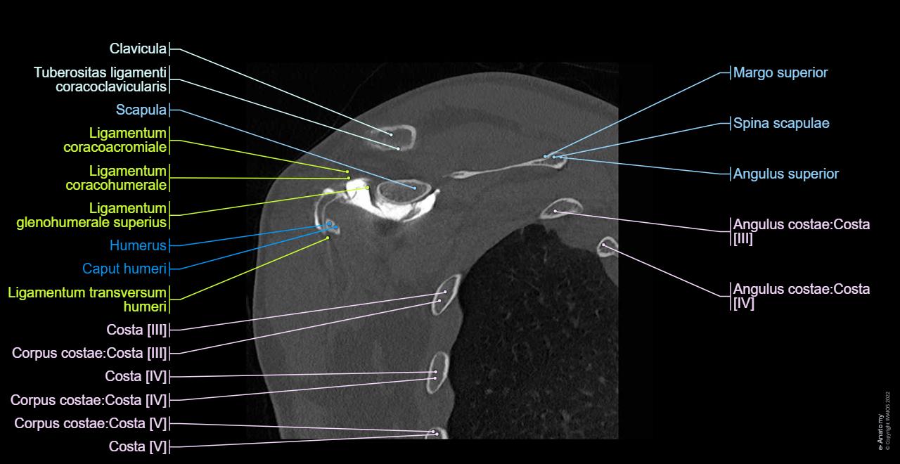 Arthro-CT der Schulter: normale anatomie | e-Anatomy