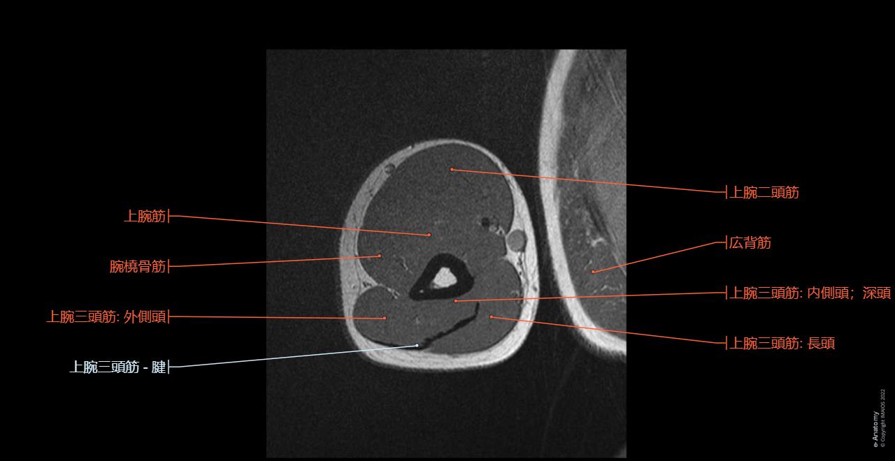 母指の解剖:注釈付きMri _ 【母指のしくみ】親指だけ違う動きをする理由を解説! – RWYVC