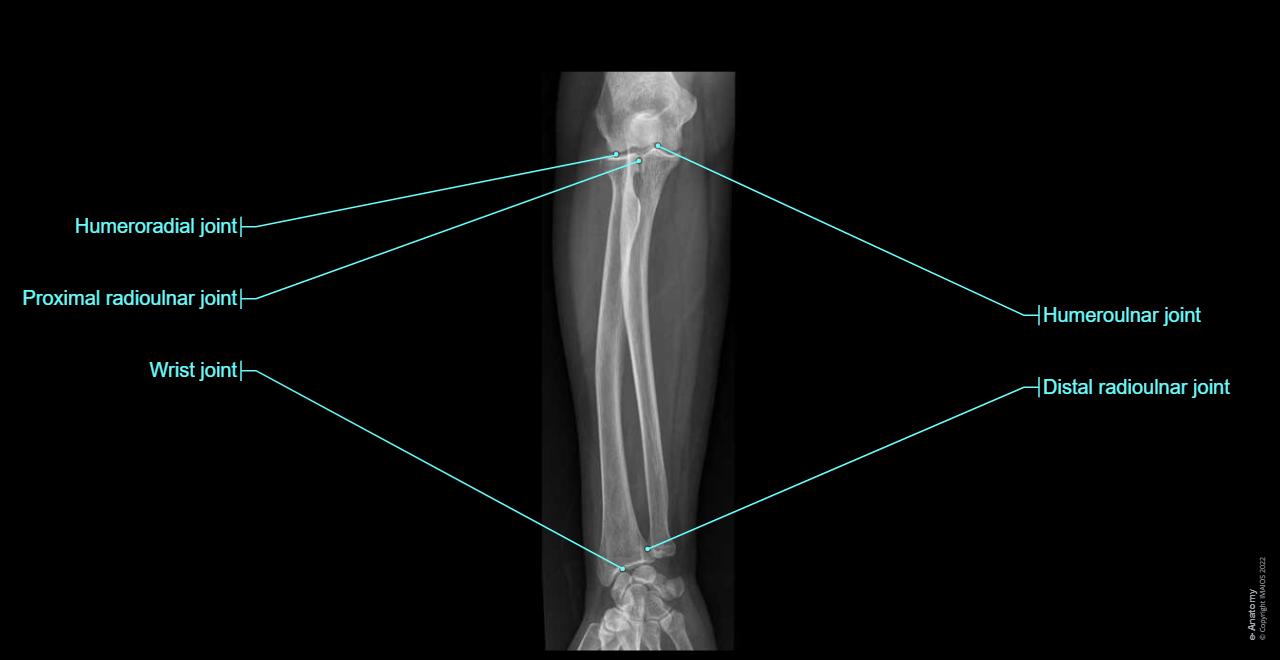 Radiological anatomy of the upper limb : normal anatomy | e-Anatomy