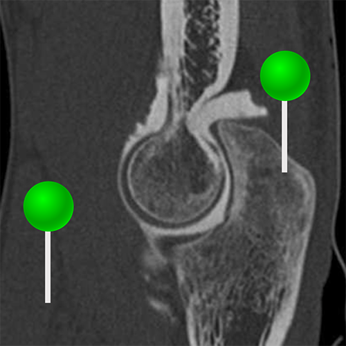 Elbow CT arthrography: normal anatomy | e-Anatomy