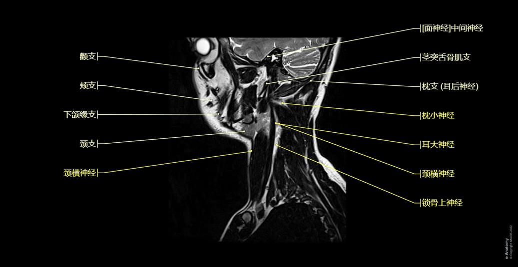脸与颈部 MRI : 正常解剖 | e-Anatomy