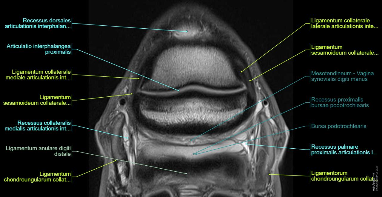Fuß- und Hufanatomie des Pferdes im MRT : normale anatomie | vet-Anatomy