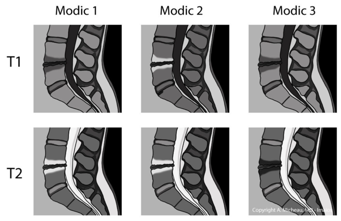 Glossário de classificações radiológicas
