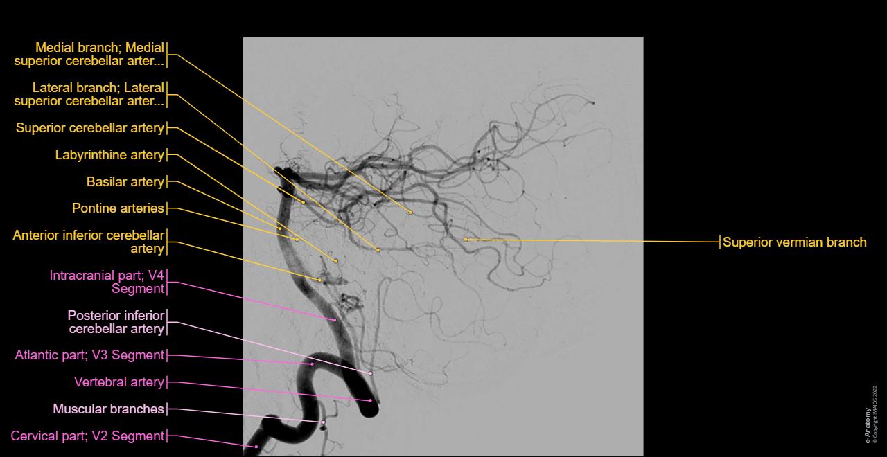 Arteries of brain Angiography: normal anatomy | e-Anatomy