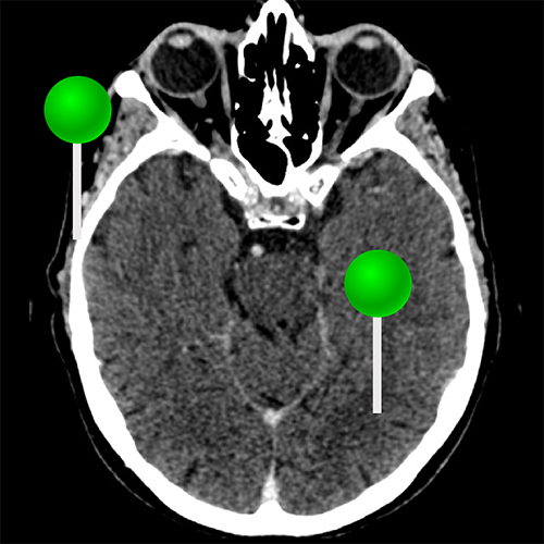 E Anatomy Imaios