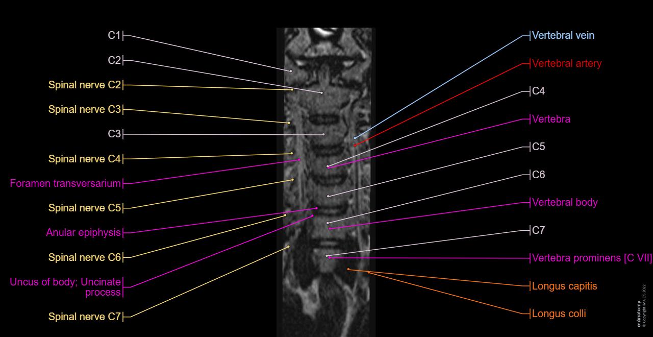 Cervical Spine Mri Labeled 689 Mri Cervical Stock Photos Free cervical-spine-mri-labeled-689-mri-cervical-stock-photos-free