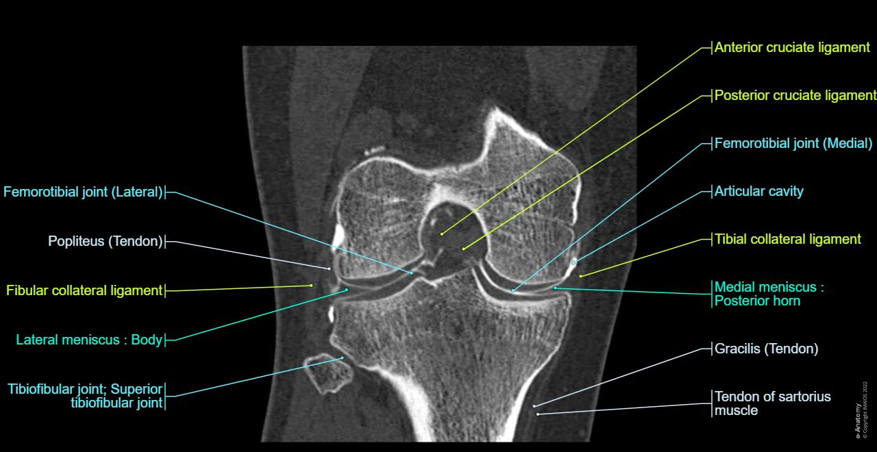 Anatomy of the knee (CT arthrography) | e-Anatomy