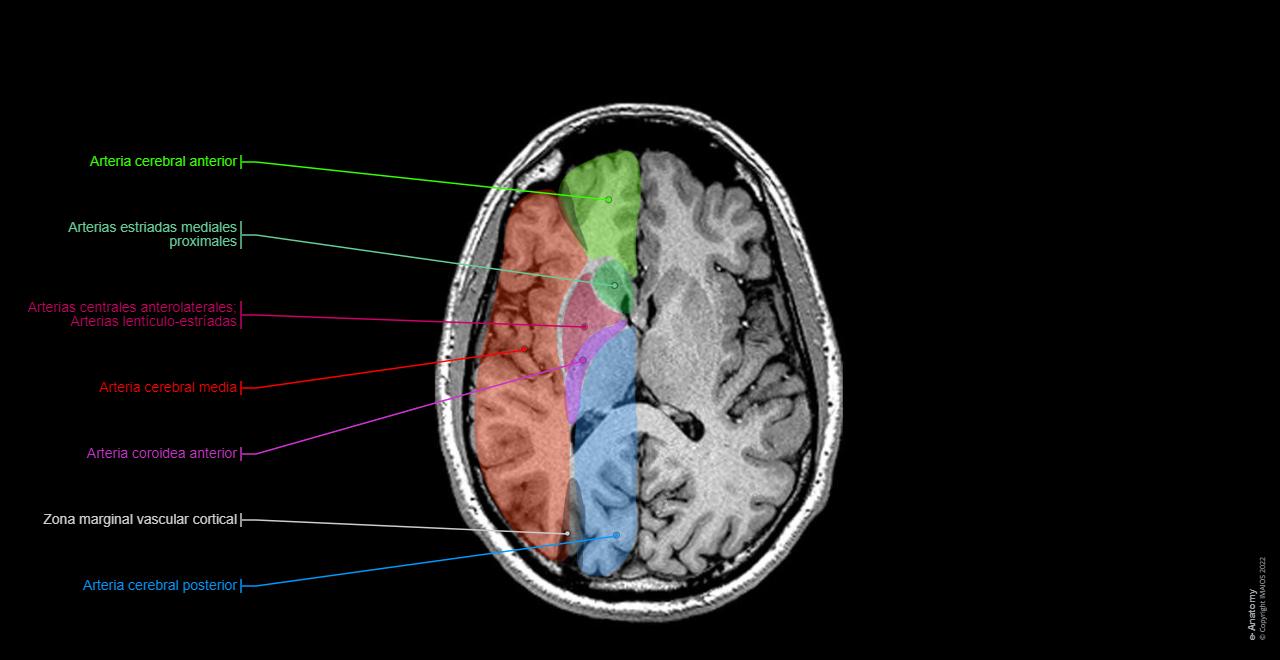 Brain Segment Normal Anatomía Cerebral Vascular ANATOMÍA VASCULAR DEL CEREBRO.