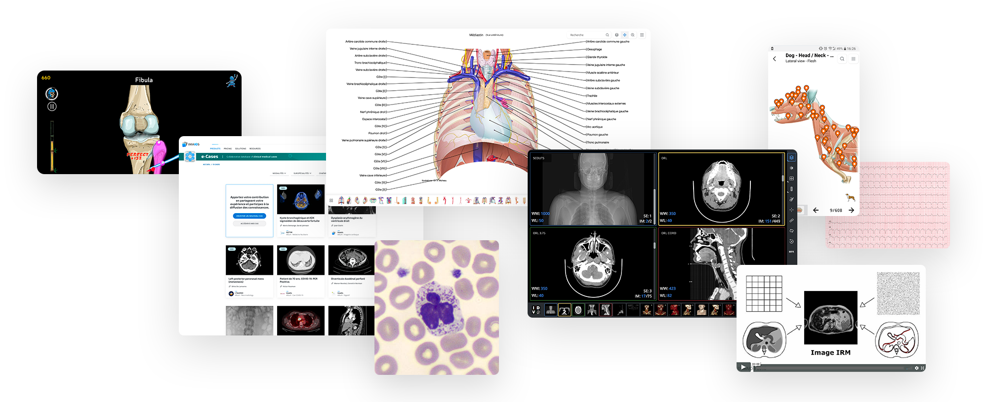 Anatomia, imagens médicas e e-learning para profissionais de saúde - IMAIOS