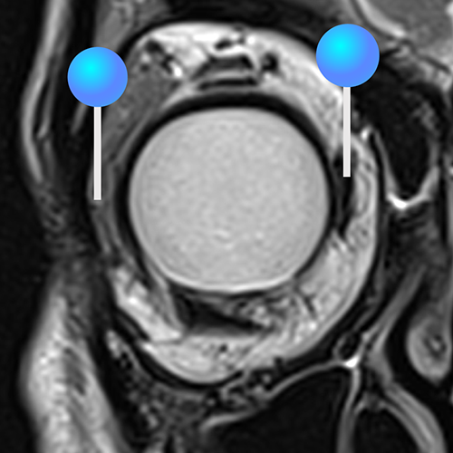 Orbits Mri Master Anatomy of the orbits: annotated MRI | e-Anatomy